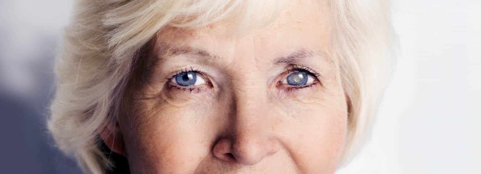 Cataract Surgery in Gainesville